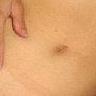 Navel  9